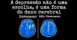 Nova Pesquisa Mostra Que A Depressão Causa Danos Cerebrais, Não O Contrário Nova Pesquisa Mostra Que A Depressão Causa Danos Cerebrais, Não O Contrário