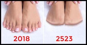Evolution's Next Step - 15 Body Parts Future Humans May Not Have Evolution's Next Step - 15 Body Parts Future Humans May Not Have
