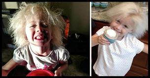 Little Girl Has 'Einstein Hair' - A Rare Mutation You've Probably Never Seen - And She's Beautiful Little Girl Has 'Einstein Hair' - A Rare Mutation You've Probably Never Seen - And She's Beautiful