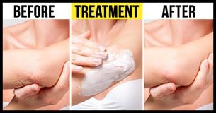 10 Natural And Inexpensive Remedies For Frustrating Skin Conditions 10 Natural And Inexpensive Remedies For Frustrating Skin Conditions