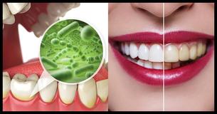 Stop Bad Breath In Its Tracks With These Seven Helpful Tips Stop Bad Breath In Its Tracks With These Seven Helpful Tips