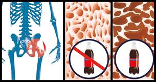 9 Foods You Didn't Know Can Be Bad For Your Body 9 Foods You Didn't Know Can Be Bad For Your Body