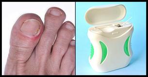 Ongles de pied incarnés: 6 remèdes maison d'une efficacité surprenante Ongles de pied incarnés: 6 remèdes maison d'une efficacité surprenante