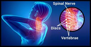 10 Simple, All-Natural Remedies To Neck Pain You Can Use Right Now 10 Simple, All-Natural Remedies To Neck Pain You Can Use Right Now