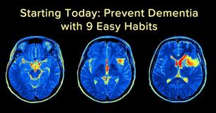 Dementia Prevention You Should Start Today with 9 Simple Habits Dementia Prevention You Should Start Today with 9 Simple Habits