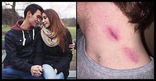 17 Jaar Oude Jongen Overlijdt Aan Een Beroerte Nadat Zijn Vriendin Hem Zuigzoenen Gaf 17 Jaar Oude Jongen Overlijdt Aan Een Beroerte Nadat Zijn Vriendin Hem Zuigzoenen Gaf
