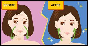 Why You Have Bulldog Cheeks And 3 Ways To Avoid Expensive Treatments Why You Have Bulldog Cheeks And 3 Ways To Avoid Expensive Treatments