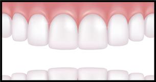 All You Need Are These 4 Natural Remedies To Grow Back Receding Gums All You Need Are These 4 Natural Remedies To Grow Back Receding Gums