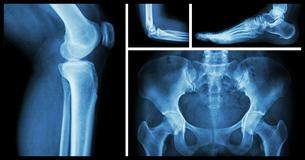 The 9 Types of Pain That Are Actually Caused By Emotional Distress The 9 Types of Pain That Are Actually Caused By Emotional Distress