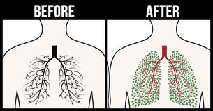 These All-Natural Yet Effective Techniques Will Help You Detox Your Body From Nicotine For Good These All-Natural Yet Effective Techniques Will Help You Detox Your Body From Nicotine For Good
