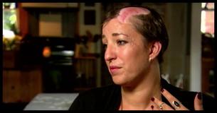 Une mère scalpée en quelques secondes envoie un avertissement urgent à toutes les femmes
Une mère scalpée en quelques secondes envoie un avertissement urgent à toutes les femmes