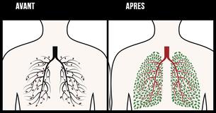 Ces techniques naturelles mais efficaces t'aideront à détoxifier ton corps de la nicotine pour de bon
Ces techniques naturelles mais efficaces t'aideront à détoxifier ton corps de la nicotine pour de bon
