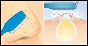 Squeaky Clean And Blemish Free Skin Thanks To A Toothbrush And Baking Powder Squeaky Clean And Blemish Free Skin Thanks To A Toothbrush And Baking Powder
