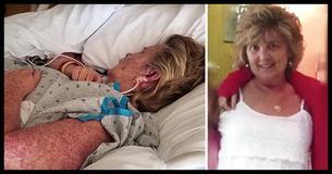 Mãe morre depois de ignorar a mordida de um inseto comum, a sua filha fala sobre o seu erro Mãe morre depois de ignorar a mordida de um inseto comum, a sua filha fala sobre o seu erro