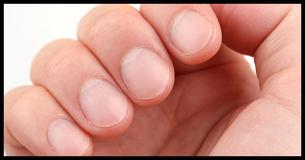13 Health Conditions That The Moons On Your Nails Can Show You 13 Health Conditions That The Moons On Your Nails Can Show You