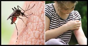 Some People Are Mosquito Magnets! Here's Why Some People Are Mosquito Magnets! Here's Why