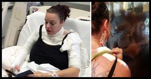 Burn Victim Peels Back Her Bandages And Is Amazed By Orangutan's Reaction To Her Scars Burn Victim Peels Back Her Bandages And Is Amazed By Orangutan's Reaction To Her Scars