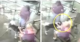 Former Model Is Bit In The Face By Dog She Patted, Undergoes Cosmetic Surgery Former Model Is Bit In The Face By Dog She Patted, Undergoes Cosmetic Surgery