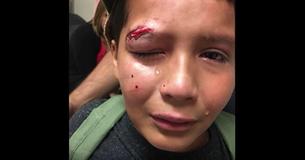 10-Year-Old Boy Refuses To Hit Back After Bully Leaves Him Bloodied: 'It's Not The Jedi Way' 10-Year-Old Boy Refuses To Hit Back After Bully Leaves Him Bloodied: 'It's Not The Jedi Way'