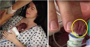 Depois de Duas Semanas Mãe Finalmente Segura Filha de 350g No Colo Depois de Duas Semanas Mãe Finalmente Segura Filha de 350g No Colo