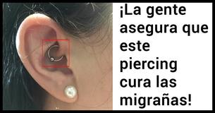 ¡Este curioso piercing es un remedio nuevo para tratar las migrañas crónicas ¡Este curioso piercing es un remedio nuevo para tratar las migrañas crónicas