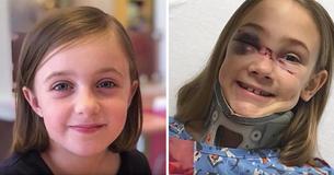 Doctors Witness Miraculous Recovery Of A Girl On Life Support After Her Parents Urge Public To Pray Doctors Witness Miraculous Recovery Of A Girl On Life Support After Her Parents Urge Public To Pray