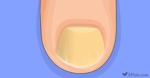 These 8 Signs You Could Potentially Have a Protein Deficiency These 8 Signs You Could Potentially Have a Protein Deficiency