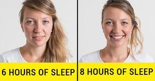 7 Side Effects Of Insomnia on Your Body 7 Side Effects Of Insomnia on Your Body