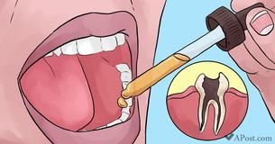 12 Natural Home Remedies to Relieve A Toothache 12 Natural Home Remedies to Relieve A Toothache