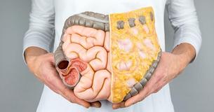 Everything You Need To Know About Visceral Fat And Why You Need To Reduce It Everything You Need To Know About Visceral Fat And Why You Need To Reduce It