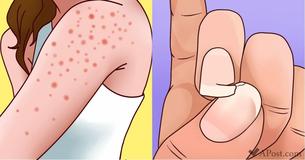 9 Symptoms Of Gluten Sensitivity You Should Never Ignore 9 Symptoms Of Gluten Sensitivity You Should Never Ignore