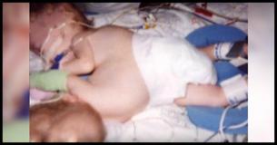 2002 kannte man diese siamesischen Zwillinge auf der ganzen Welt. Nur 11 Jahre später sind sie wieder im Fernsehen und gehen getrennte Wege 2002 kannte man diese siamesischen Zwillinge auf der ganzen Welt. Nur 11 Jahre später sind sie wieder im Fernsehen und gehen getrennte Wege