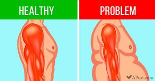 8 Early Symptoms of Muscle Degeneration You Definitely Should Not Ignore 8 Early Symptoms of Muscle Degeneration You Definitely Should Not Ignore