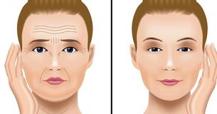 10 Ways You Can Kiss Your Sagging Face And Neck Skin Goodbye 10 Ways You Can Kiss Your Sagging Face And Neck Skin Goodbye