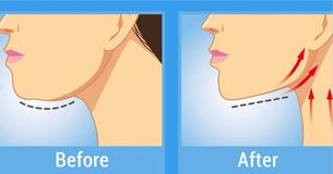 6 Foolproof Methods To Make Your Neck Look Younger 6 Foolproof Methods To Make Your Neck Look Younger
