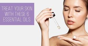 Treat Your Skin With These 6 Essential Oils Treat Your Skin With These 6 Essential Oils