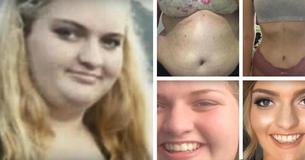 This Obese Teen Managed To Lose Over 100 Pounds In Under A Year This Obese Teen Managed To Lose Over 100 Pounds In Under A Year