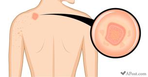 10 sinais que seu corpo apresenta quando você está muito estressado 10 sinais que seu corpo apresenta quando você está muito estressado