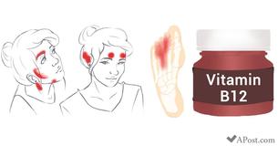 5 Ways You Can Tell If You Have Nutrient Deficiencies That Are Written All Over Your Face 5 Ways You Can Tell If You Have Nutrient Deficiencies That Are Written All Over Your Face