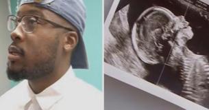 Padre de gemelos se desmaya cuando ve la ecografía de su esposa embarazada en el consultorio del médico. Padre de gemelos se desmaya cuando ve la ecografía de su esposa embarazada en el consultorio del médico.