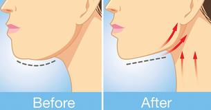 Exercises For Reducing Unwanted Neck Fat And Getting Rid Of Your Double Chin Exercises For Reducing Unwanted Neck Fat And Getting Rid Of Your Double Chin