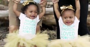 Nurse Treats Twin Infant Girls Taken To Hospital After Abuse, Adopts Them 1-Year-Later Nurse Treats Twin Infant Girls Taken To Hospital After Abuse, Adopts Them 1-Year-Later