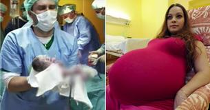 Doctors Are Besides Themselves Over Childbirth That Occurs Only Once Every 480 Years Doctors Are Besides Themselves Over Childbirth That Occurs Only Once Every 480 Years