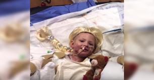 Courageous Girl Who Accidentally Set Herself On Fire Is Recovering From Her Burns Thanks To ‘Frozen’ Courageous Girl Who Accidentally Set Herself On Fire Is Recovering From Her Burns Thanks To ‘Frozen’