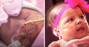 Baby Born With Heart Outside Chest Finally Out Of Hospital After 14 Months Baby Born With Heart Outside Chest Finally Out Of Hospital After 14 Months