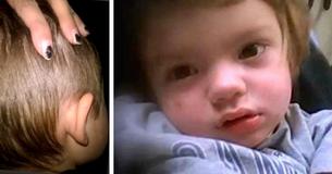 After Boy Becomes Paralyzed, Mom Finds Bug Bite That Caused It And Is Now Warning Others What To Look For After Boy Becomes Paralyzed, Mom Finds Bug Bite That Caused It And Is Now Warning Others What To Look For