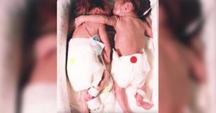 Nurse Puts Dying Baby Next To Her Twin. She Gives Her A 'Hug' And It Leads To A Miracle Nurse Puts Dying Baby Next To Her Twin. She Gives Her A 'Hug' And It Leads To A Miracle