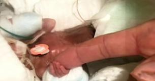Tiniest Surviving Baby Boy Ever Leaves Hospital In Good Health Tiniest Surviving Baby Boy Ever Leaves Hospital In Good Health