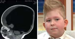 Boy Born With 'No Brain' Defies Odds To Live After It 'Grew Back' Boy Born With 'No Brain' Defies Odds To Live After It 'Grew Back'