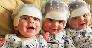 These Are The Rarest Triplets In The Entire World – Take A Closer Look These Are The Rarest Triplets In The Entire World – Take A Closer Look